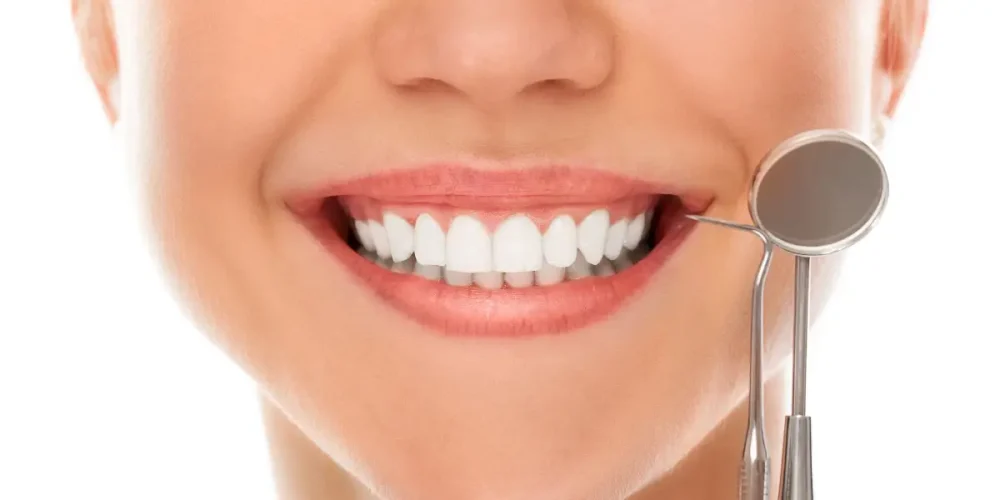 Smile Makeover με πορσελάνη έναντι σύνθετων καπλαμάδων